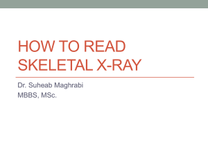How to read skeletal x-ray